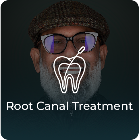 https://global.esnandentalclinics.com/wp-content/uploads/2025/02/Root-Canal-Treatment.png